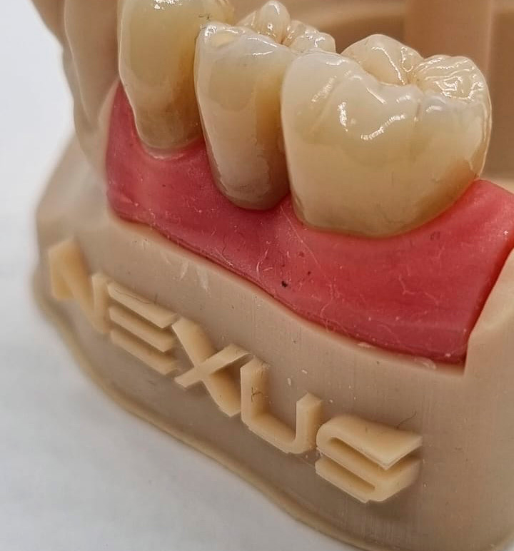 Dentadura probada por Nexus Digital