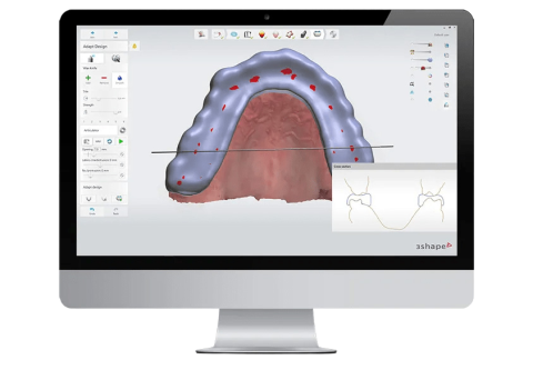 Software CAD/CAM Dental para Laboratorios | Nexus Digital